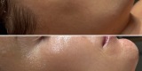 La Lilla Estetic | Kosmetologia | Uroda, makijaż ślubny Poznań, wielkopolskie - zdjęcie 4