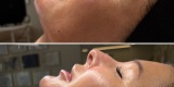 La Lilla Estetic | Kosmetologia | Uroda, makijaż ślubny Poznań, wielkopolskie - zdjęcie 6